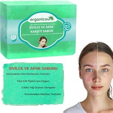 Aesco Doğal Akne ve Sivilce Karşıtı Sabun 140 gr 1 Adet Tüm Cilt Tipleri Için Natural Sabun