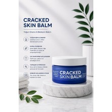 Nacario Çatlak Deri Balsamı, Sea Buckthorn, Tamanu Oil, Calendula ve Jojoba Ile, Nemlendirici, 50 ml