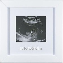 Nacario Fufizu Ilk Fotoğrafım Bebek Ultrason Çerçevesi - Bebek Odası Resim Anı Çerçevesi