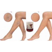 Bezos Varison Va.ris Selü.lit Bacak Bakım Kremi 200 ml x 2ADET