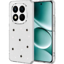 Aesco Mey Ithalat®   Redmi Note 15 4g Fiyonk Desenli Kapak - Desen 7