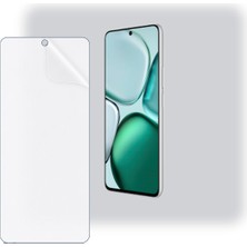 Schitec Honor X9C Smart Uyumlu Ön Yüzey Nano Şeffaf Hidrojel Ekran Koruyucu