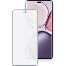 Schitec Honor X9C Uyumlu Ön Yüzey Nano Şeffaf Hidrojel Ekran Koruyucu