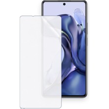 Schitec Xiaomi 11T Uyumlu Ön Yüzey Nano Şeffaf Hidrojel Ekran Koruyucu
