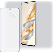 Schitec Honor X60 Uyumlu Ön Yüzey Nano Şeffaf Hidrojel Ekran Koruyucu