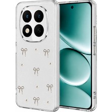 Muratech Newface Xiaomi Redmi Note 15 4g Fiyonk Desenli Kapak - Desen 5
