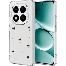 Muratech Newface Xiaomi Redmi Note 15 Pro Plus 5g Fiyonk Desenli Kapak - Desen 1