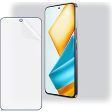 Schitec Honor 90 Gt Uyumlu Ön Yüzey Nano Şeffaf Hidrojel Ekran Koruyucu