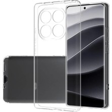 Ummeslem Xiaomi Redmi Note 14 Pro Plus Kılıf Cep Telefenu Için Uyumlu Süper Silikon Kapak