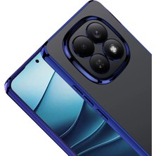 Ummeslem Xiaomi Redmi Note 15 Pro 4g Kılıf Kamera Korumalı Logo Gösteren Için Uyumlu Omega Kapak