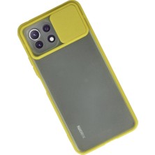 Eco Port Xiaomi Mi 11 Lite Kılıf Palm Buzlu Kamera Sürgülü Silikon - Sarı