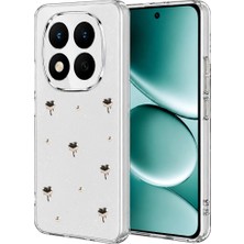 Eco Port Xiaomi Redmi Note 15 4g Fiyonk Desenli Kapak - Desen 1