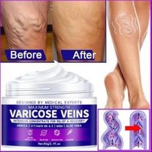 Bezos Strngth V.ricose Ve.n Tedavi Kremi 100 ml x 3 Adet
