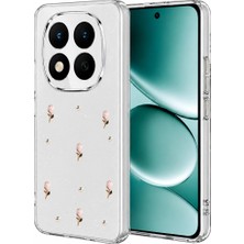 Küçük Hazine Xiaomi Redmi Note 15 Pro Plus 5g Fiyonk Desenli Kapak - Desen 6