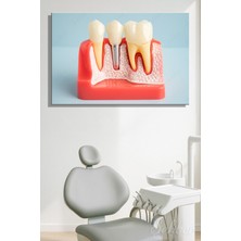 Şehber Yatay Kanvas Tablo Tekli Ağız Diş Sağlığı Dişçi Poliklinik Hastane Dental Implant Simülasyonu 2949