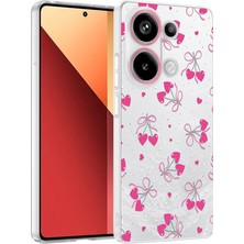 Ceponya Xiaomi Redmi Note 13 Pro 4g Kılıf Kamera Korumalı Canlı Lüx Desenli Klip Sert Kapak