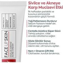 Vavis Akne Kremi Yüz Için – Sivilce ve Akne Karşıtı Leke Kremi – Salisilik Asit & Niasinamid ile Leke Giderici – Genç ve Yetişkin Cilt Bakımı, 40 ml