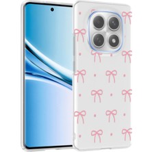 Halkhouse Redmi Note 14 Pro 4g Kılıf Kamera Korumalı Desenli Sert Silikon Klip Kapak
