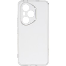 Zore Honor 400 Pro Kılıf Darbe Önleyici Anti Shock Özellikli Kamera Korumalı 2mm Silikon Emp