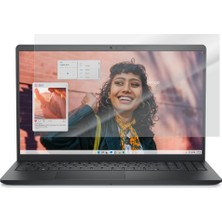 Starseven Engo 15 3530 15.6 Inç Mat Şeffaf