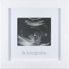 Starseven Fufi̇zu Ilk Fotoğrafım Bebek Ultrason Çerçevesi - Bebek Odası Resim Anı Çerçevesi