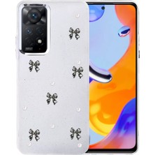 Renas Store Xiaomi Redmi Note 11 Pro Fiyonk Desenli Kapak - Desen 8