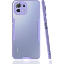 Renas Store Newface Xiaomi Mi 11 Lite Kılıf Platin Silikon - Lila