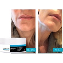 Kap Kaç Dr Botokss Cildinizin Yeniden Yapılanması Için Kırışıklık Giderci Bakım Kremi 50 ml x 1 Adet