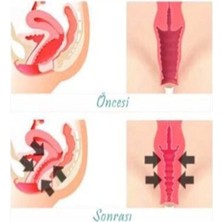 TeknoKapsül Vagitight Kadınlara Özel Genital Bölge Şekillendirici Krem 100 ml x 3 Adet