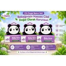 Tıny Buds 3'lü Baby Acne Bebek Aknesi Yatıştırıcı Krem 3X20GR