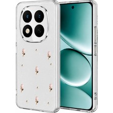 Flzdgnkr Newface Xiaomi Redmi Note 15 Pro 5g Fiyonk Desenli Kapak - Desen 6