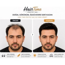 6.8 Erkek Protez Saç Her Yöne Taranabilir