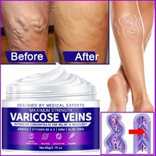 TeknoKapsül Maximum Strength Varicose Veins Krem 100 ml 1 Adt