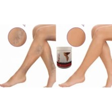 Kap Kaç Kremi 200ML / Varison Cream 200ML x 2 Adet