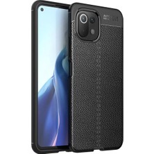 Bezos Mi 11 Lite Kılıf Auto Focus Kapak - Siyah