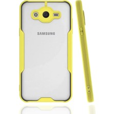 Dunai Store Newface Samsung Galaxy J7 Kılıf Platin Silikon - Sarı
