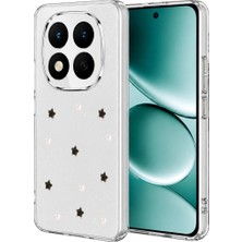 Küçük Hazine Xiaomi Redmi Note 15 Pro Plus 5g Fiyonk Desenli Kapak - Desen 7