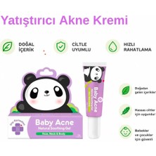 Tıny Buds Baby Acne Bebek Aknelerini Yatıştırıcı Krem 20GR