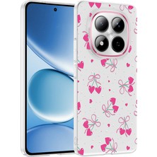 Teknook Xiaomi Redmi Note 15 Pro Plus Kılıf Kamera Korumalı Desenli Zore Klip Kılıf - Kalpli Kiraz