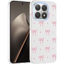 Teknook Xiaomi 15T Kılıf Kamera Korumalı Desenli Zore Klip Kılıf - Fiyonk
