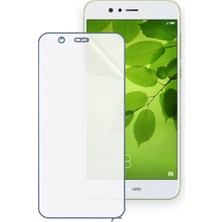 Schitec Huaweı Nova 2 Plus Uyumlu Ön Yüzey Nano Şeffaf Hidrojel Ekran Koruyucu