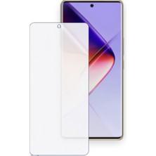 Schitec Infinix Note 40 Pro 4g Uyumlu Ön Yüzey Nano Şeffaf Hidrojel Ekran Koruyucu