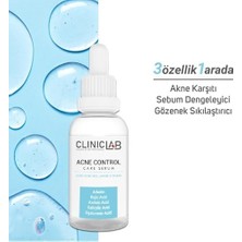 Akne Kontrol Bakım Serumu 30 ml