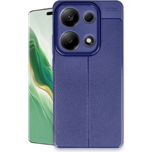 KSB Store Mey Ithalat®   Redmi Note 13 Pro 4g Kılıf Auto Focus Kapak - Lacivert