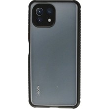 Royaleks Xiaomi Mi 11 Lite Kılıf Miami Şeffaf Silikon - Siyah