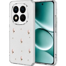 Aesco Xiaomi Redmi Note 15 Pro 5g Fiyonk Desenli Kapak - Desen 6