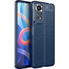 Redmi Note 11 Global Kılıf Kamera Koruyuculu Niss Deri Görünümlü Silikon Kapak