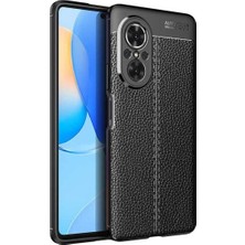 Huawei Nova 9 Se Kılıf Kamera Koruyuculu Niss Deri Görünümlü Silikon Kapak