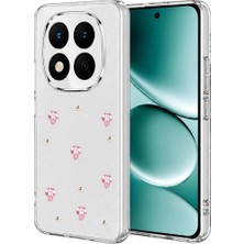 Aesco Xiaomi Redmi Note 15 Pro 5g Fiyonk Desenli Kapak - Desen 3
