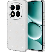 Aesco Xiaomi Redmi Note 15 Pro 5g Fiyonk Desenli Kapak - Desen 10